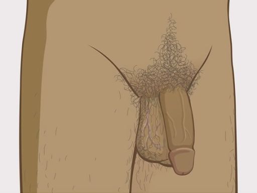 082 besneden penis