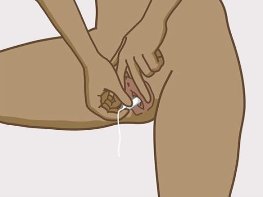 100 instructie tampon stap2