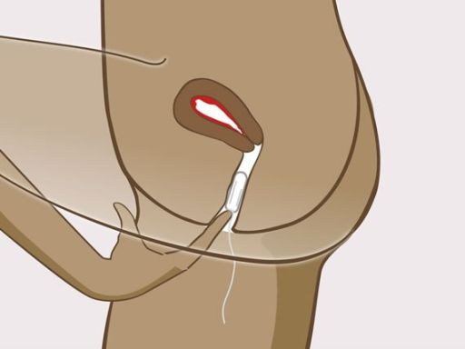 101 instructie tampon stap3