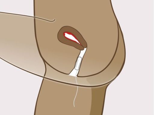 102 instructie tampon stap4