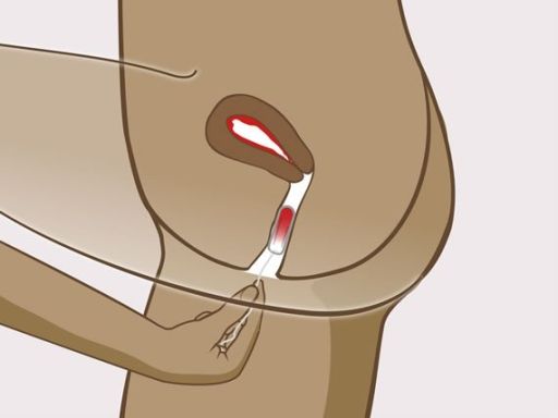 103 instructie tampon stap5