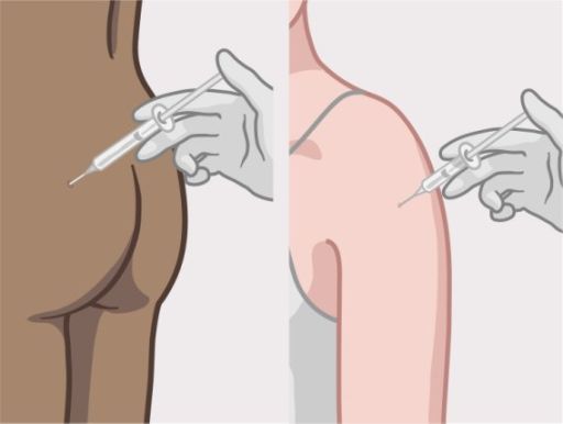 136b injecteren prikpil versie1