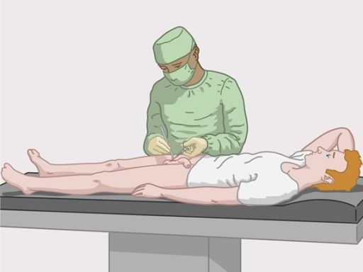 144 sterilisatie operatie