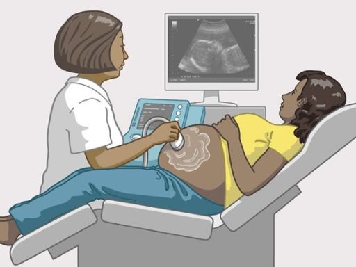 53 ultrasoundscan