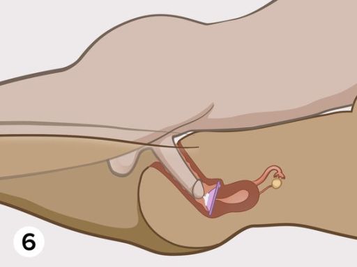 Diaphragm step6