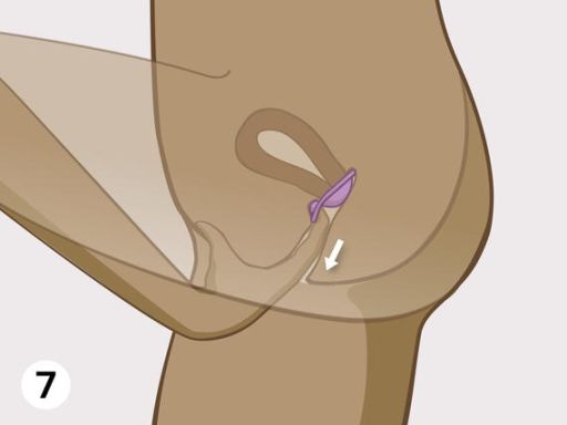 Diaphragm step7