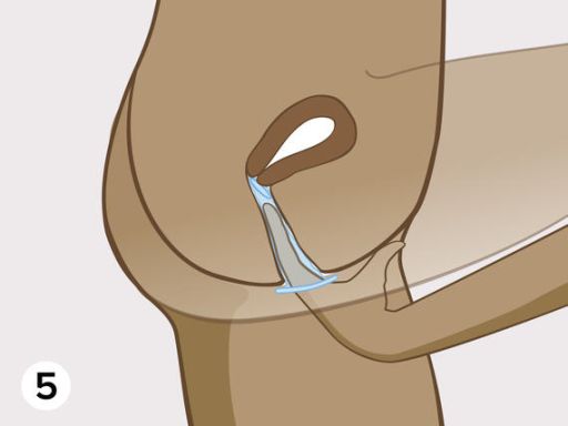 Female condom step5