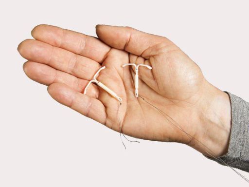 Hormonaal spiraal