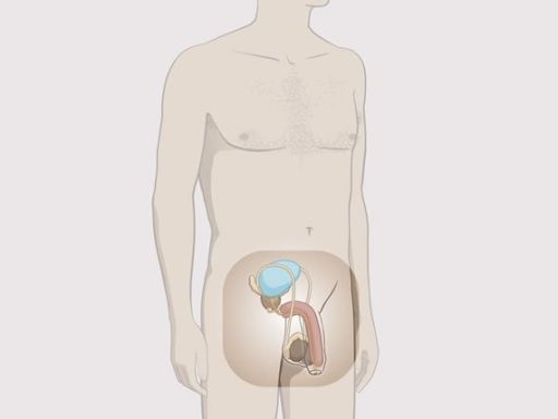 Mansinternalsexualorgans manstanding 0