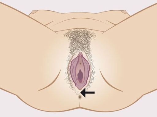 140 perineum