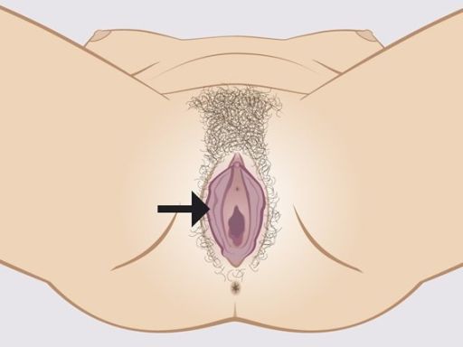 157 labia