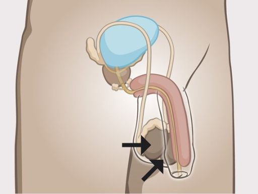 184 testicle