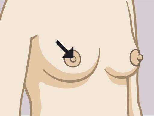 185 nipple