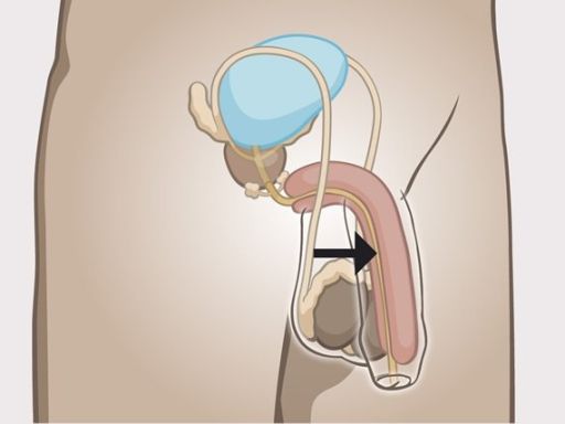 194 urethra