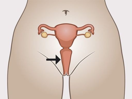 197 vagina