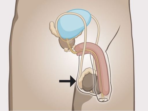 20 scrotum