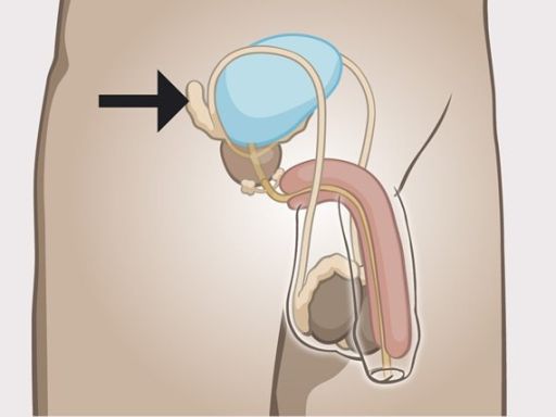 231 seminal vessicle