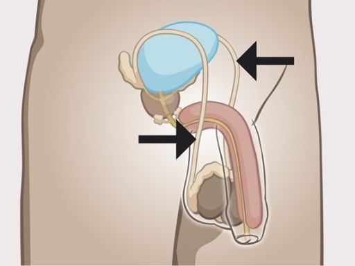 233 spermduct