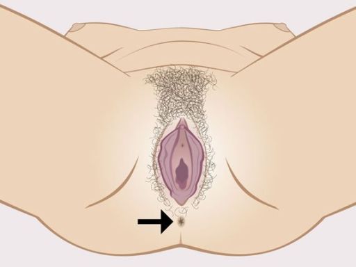 2 anus