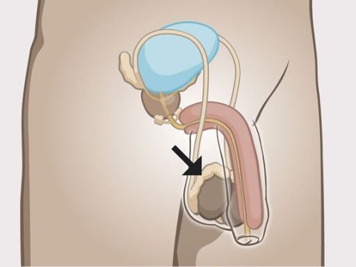 31 epididymis