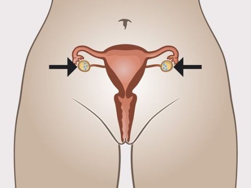 57 ovary