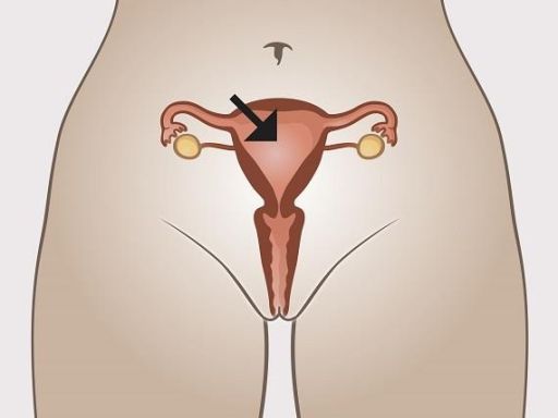 Bzga womaninternal 1